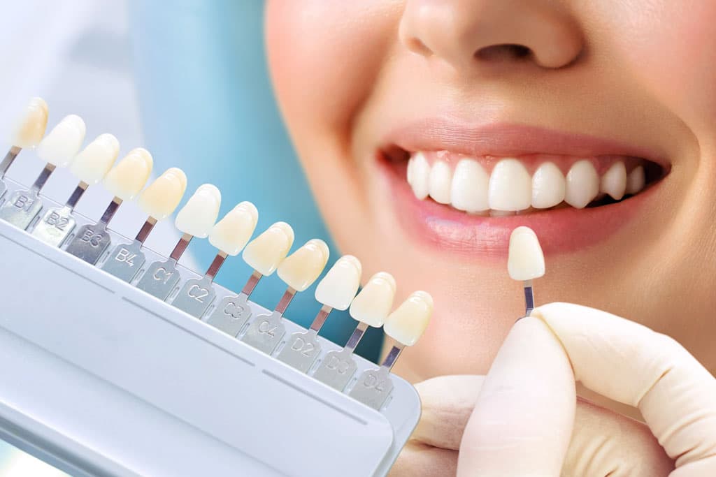 Blanqueamiento dental, carillas y otros tratamientos de odontología estética