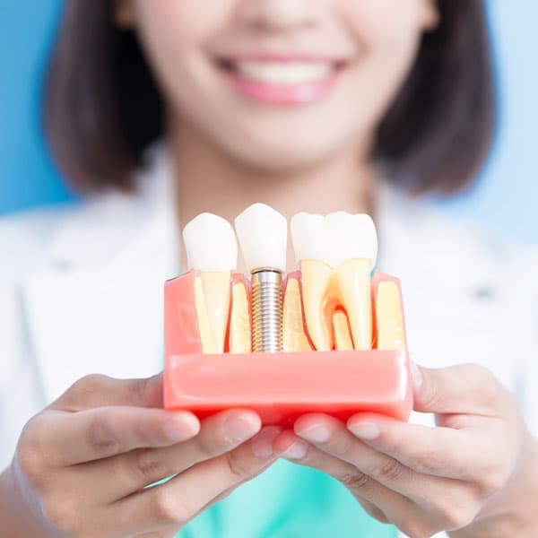 Implantes dentales en Pontevedra