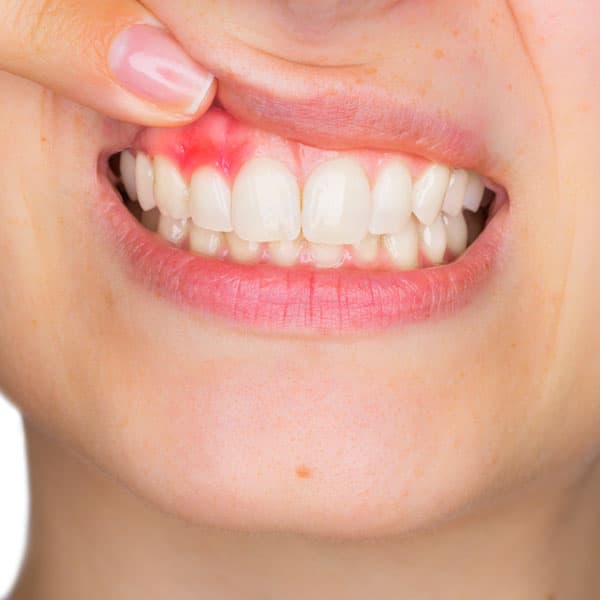 Periodoncia