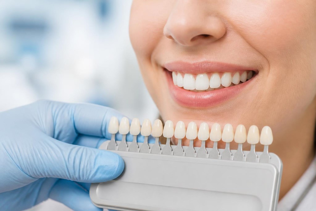 Foto 1 Recupera tu sonrisa con nuestro tratamiento de estética dental y carillas en Pontevedra